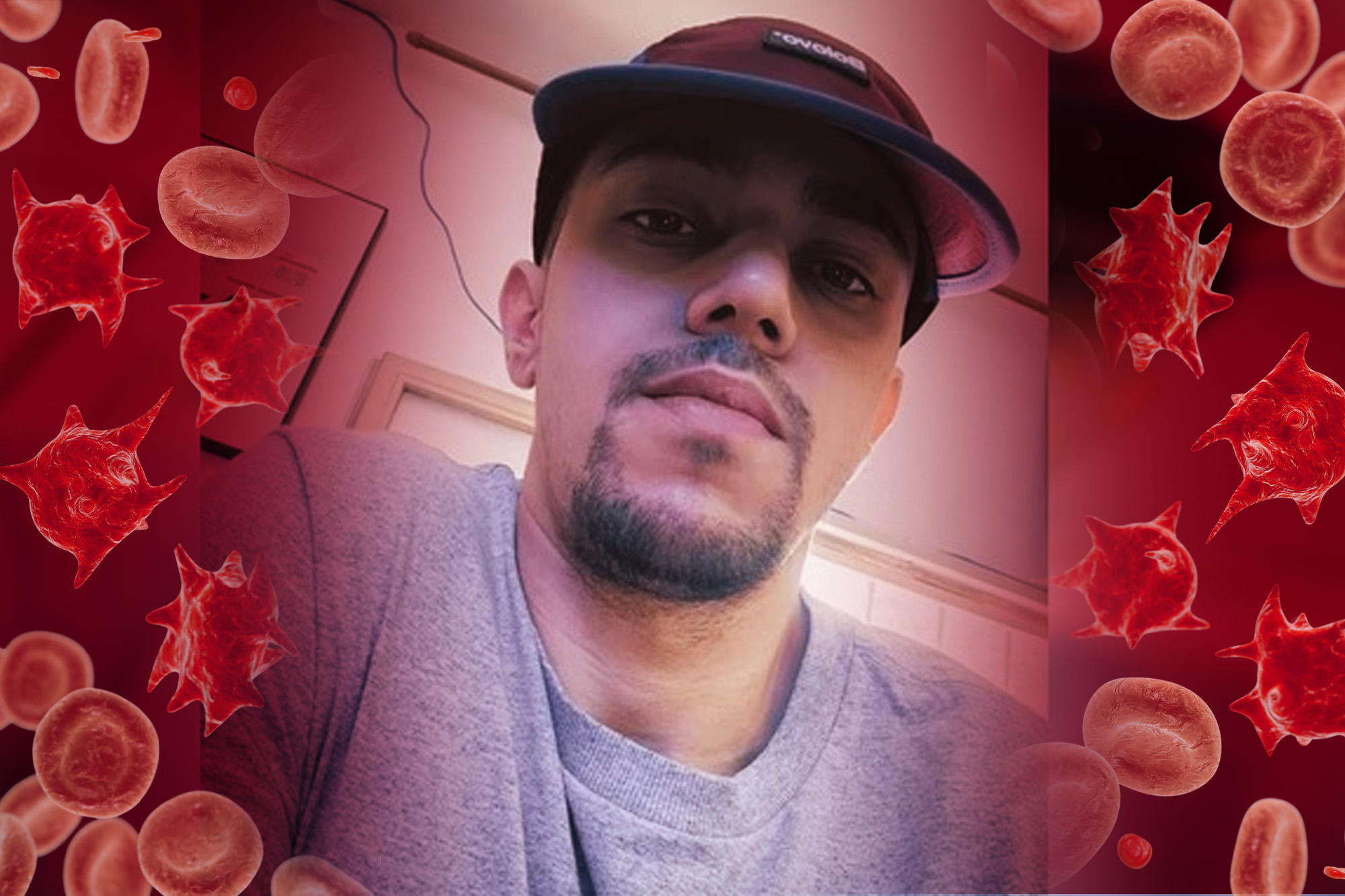 Anemia hemolítica: entenda doença rara que matou jovem chef de cozinha