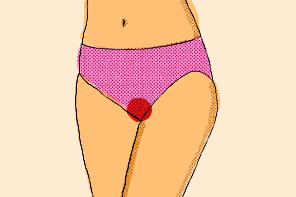Menstruação - Metrópoles
