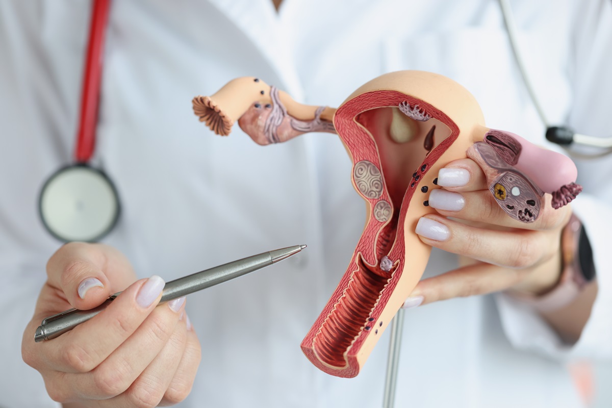 Foto de médica mostrando vulva - ninfoplastia