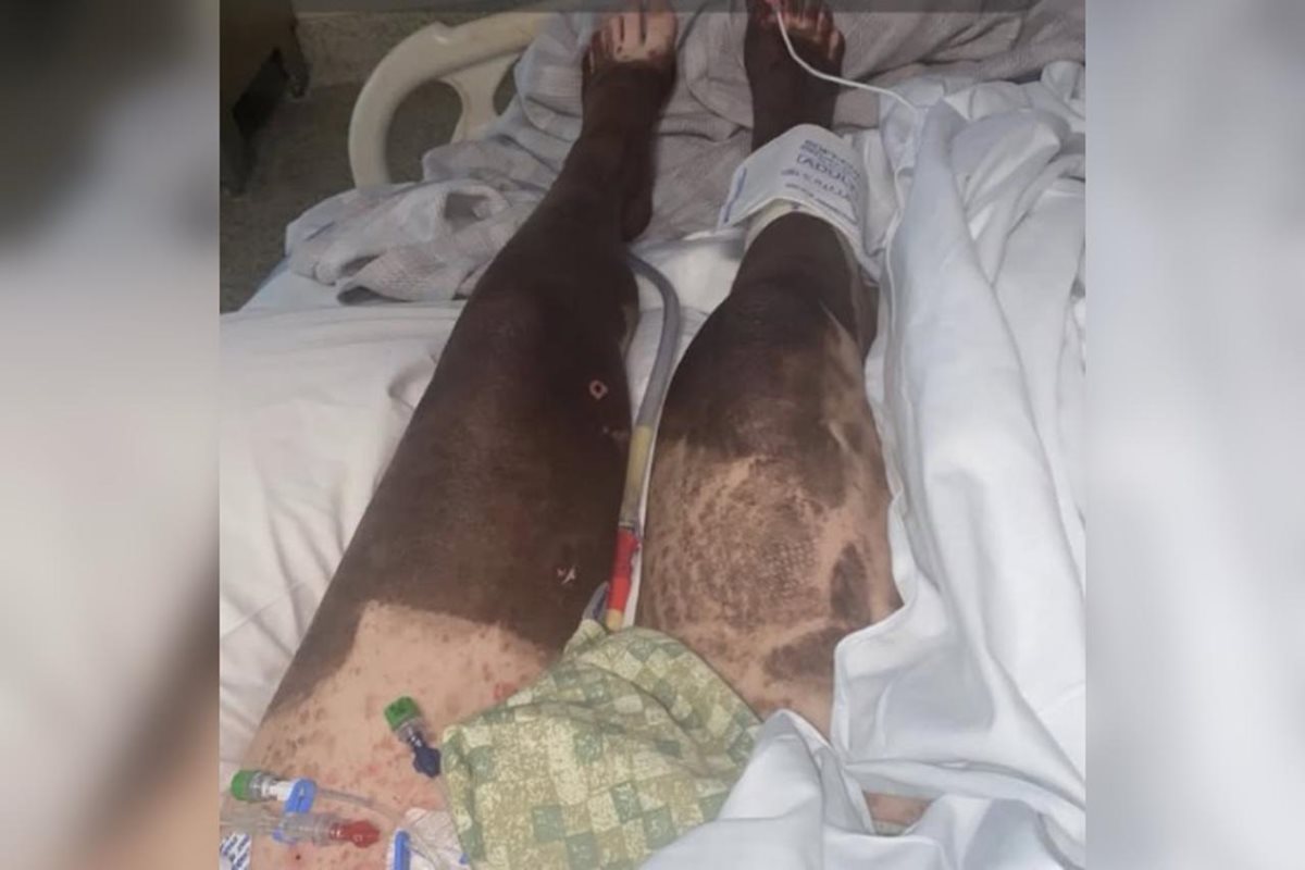 Pernas humanas fotografadas em ambiente hospitalar - Metrópoles