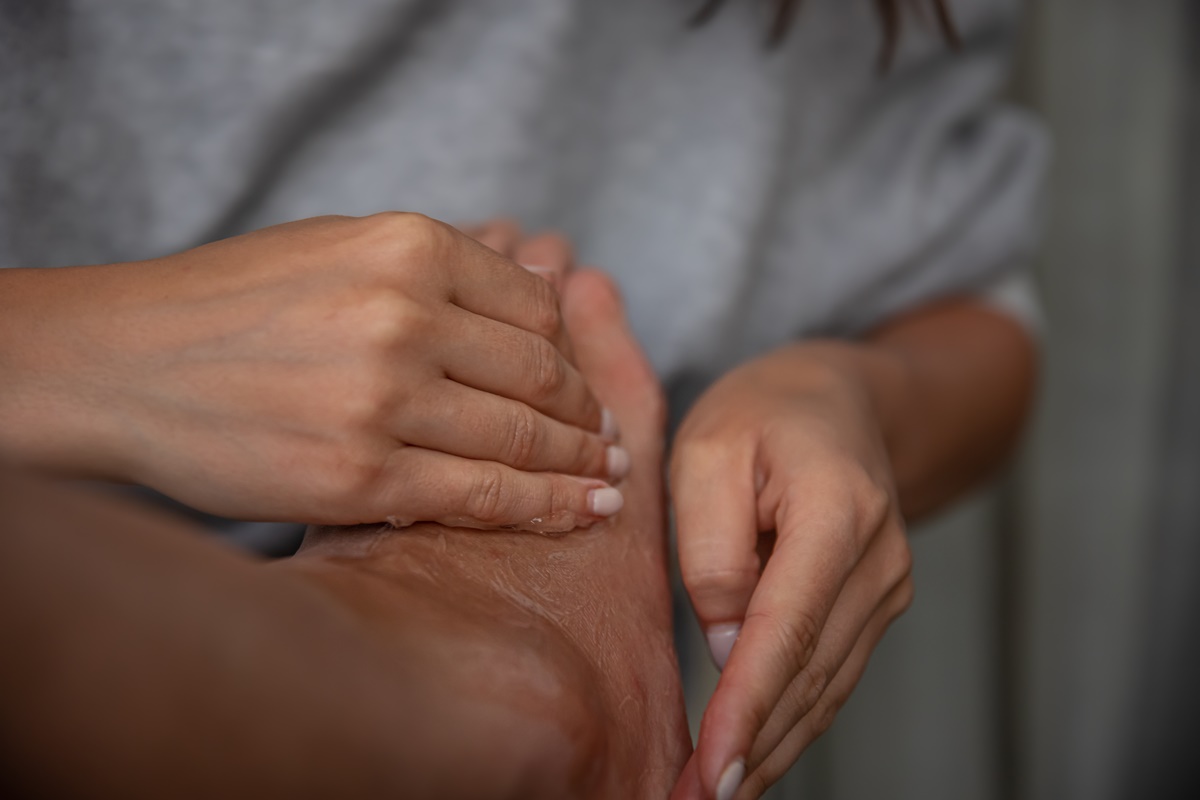 Foto colorida de mulher passando gel na ferida do pé. Gel, cicatrização, feridas diabéticas