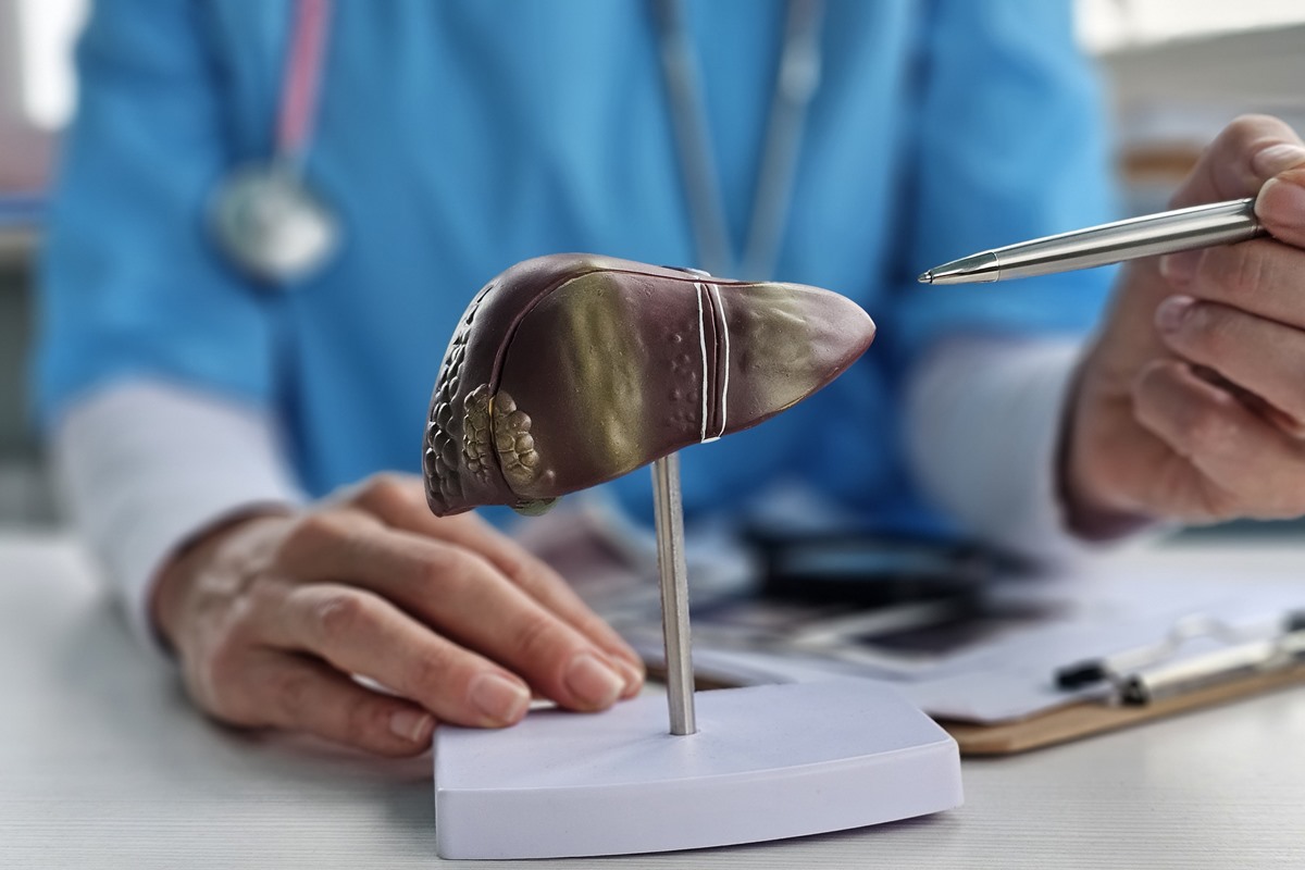 Médico examina modelo de fígado com foco em doenças. Problemas como hepatite hepática, cirrose e câncer. Metrópoles