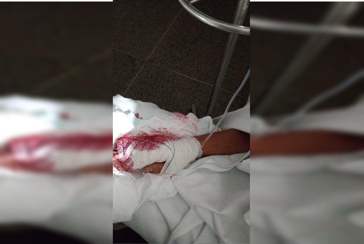 Jovem que teve corte profundo na mão aguarda atendimento há 6 dias
