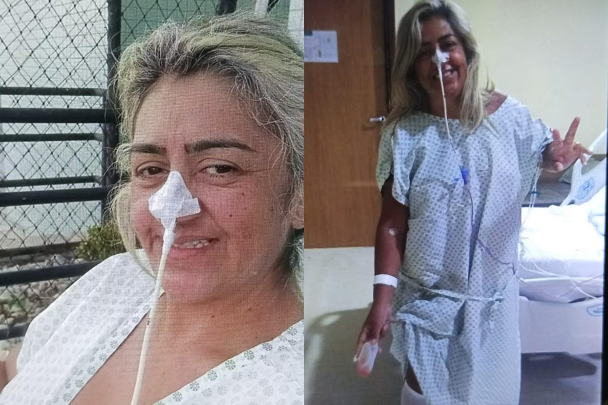 Foto colorida de mulher com sonda nasal - Metrópoles. 
