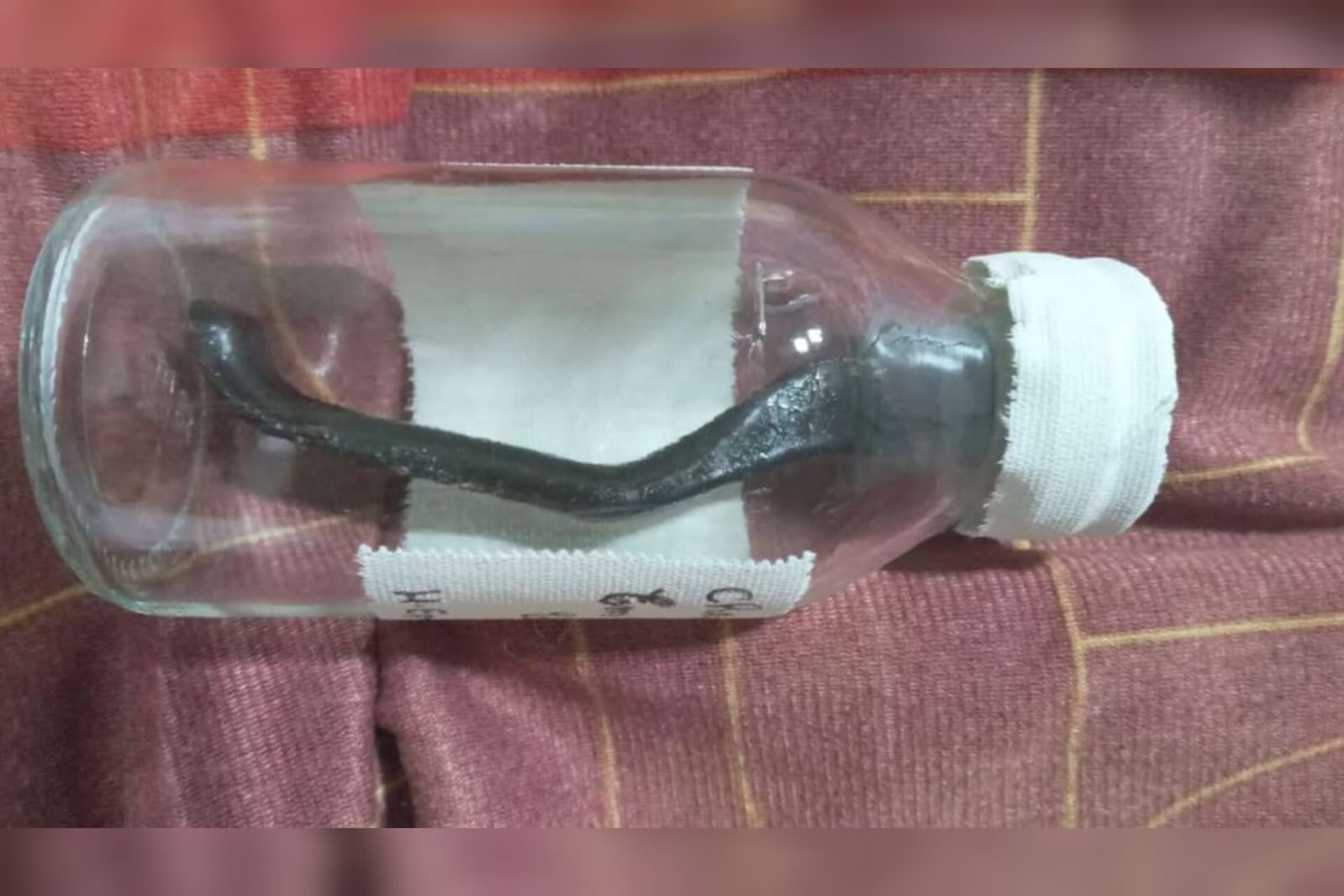 Ciclista atropelado fica 9 meses com peça de bicicleta na barriga