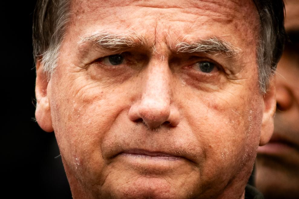 Boletim: médicos retiraram oito lesões de pele em Bolsonaro