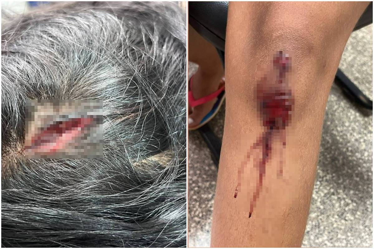 Jovem é brutalmente agredida a pedradas por cunhado no Entorno do DF