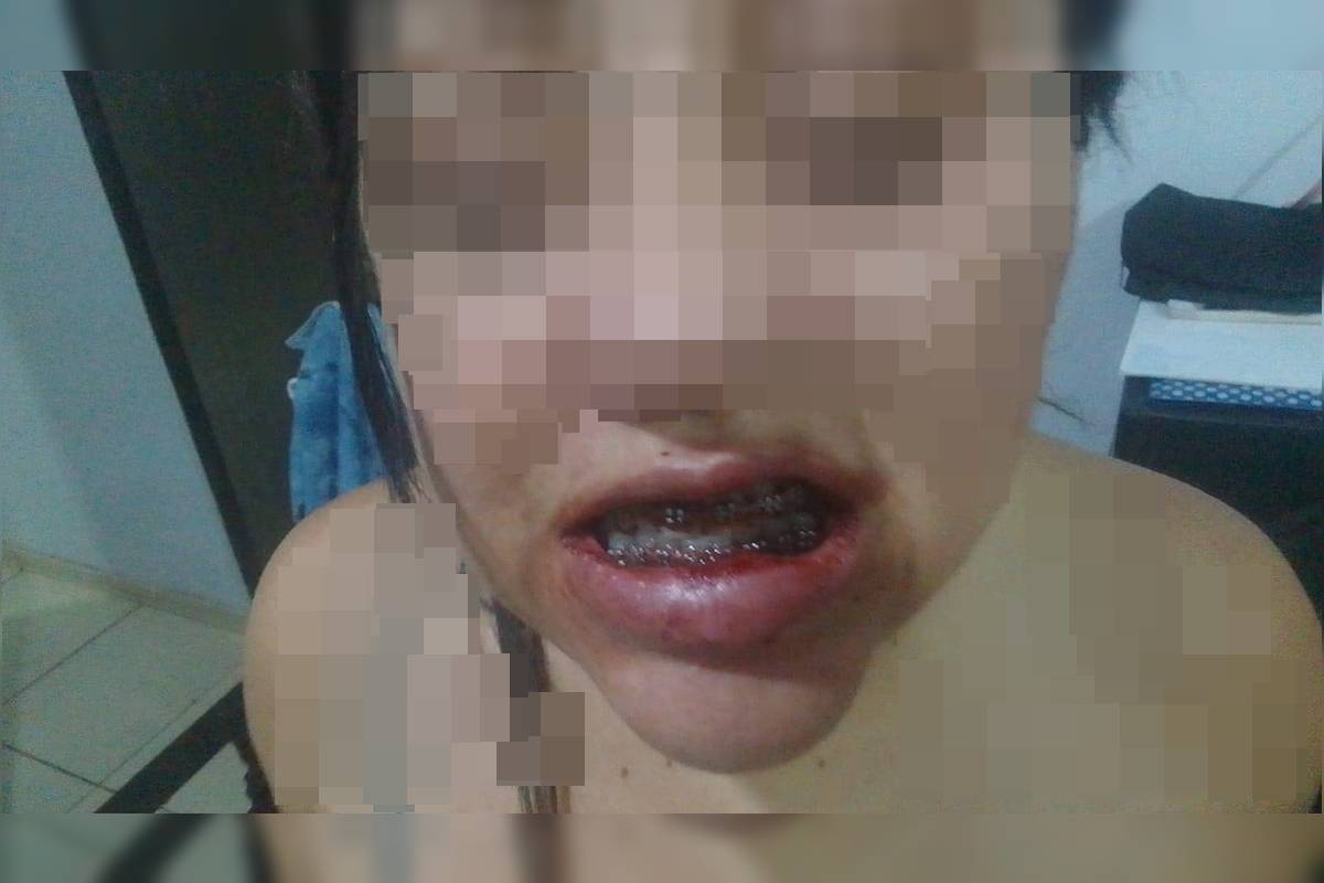 Veja como ficou mulher agredida pelo companheiro em escada de prédio