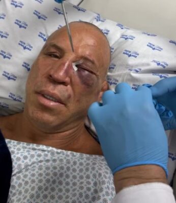Imagem colorida de Wanderlei Silva após a luta contra Popó- Metrópoles