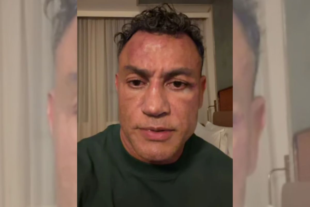 Popó quebrou a mão e teve sangramento na cabeça após pancadaria