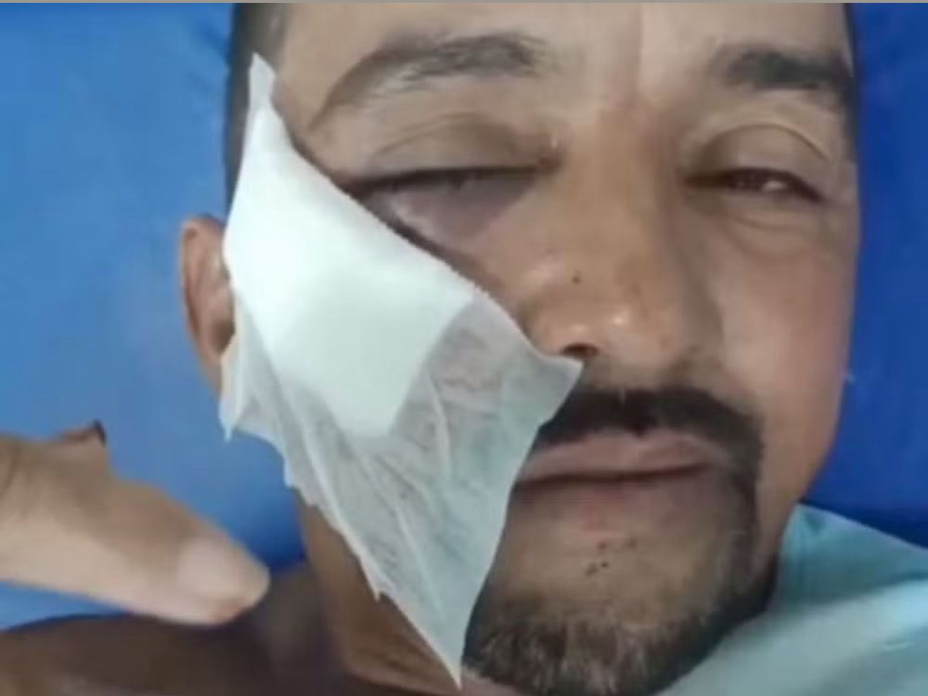 Gari é Atacado com Tijolada no Rosto Após Desentendimento Sobre Lixo: Veja o Que Aconteceu!